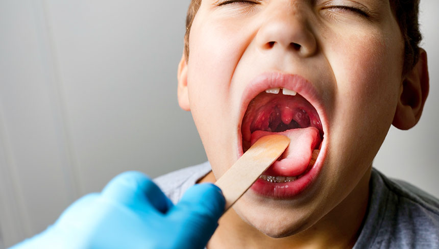 patient needing tonsillitis treatment in Salinas